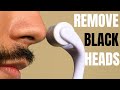 How to Professionally Remove Blackheads At Home | Use THESE Tricks