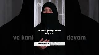 Gal Dili Dışarıdaydı.