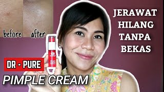 3 hari setelah pakai DR-Pure PIMPLE CREAM