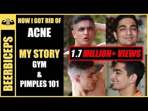 GOODBYE FOREVER, ACNE - Pimples treatment  | BeerBiceps Acne & Fitness