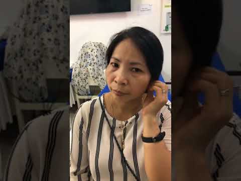 Khách hàng trị nám Hori cấp độ 4 cách đây 3 năm giờ đã sạch không tỳ vết