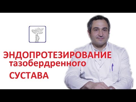 Эндопротезирование сустава. И