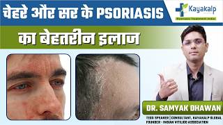 Scalp Psoriasis से Face पर लाल पैच क्यों आते हैं? | face and scalp Psoriasis | Psoriasis treatment