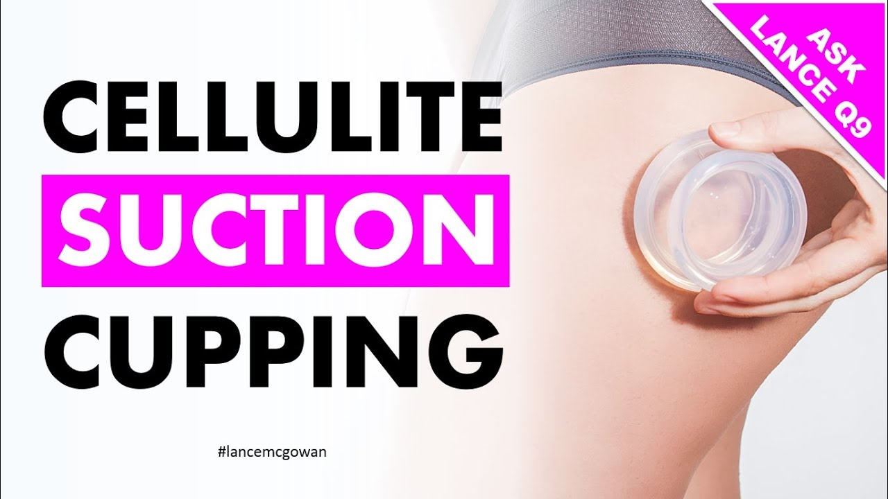 Cellulite Suction Cup Does It Really Reduce Stress? YouTube