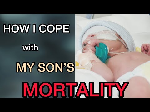 Trisomy 13: MORTALITY || Learning to live with my son&rsquo;s genetic condition ( 13トリソミー ) Patau Syndrome