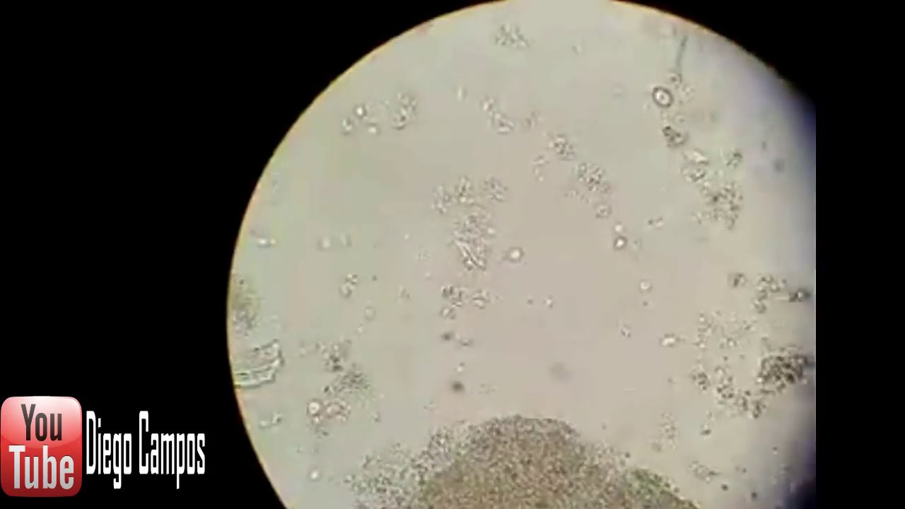 trichomonas hominis cuadro clinico