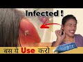 How to heal infected ear piercing faster  100 result  ravinaa gupta