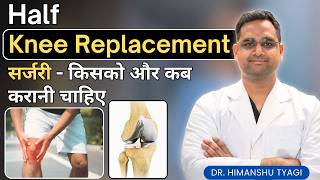 Half Knee Replacement सर्जरी - किसको और कब करानी चाहिए | unicondylar knee arthroplasty for knee pain