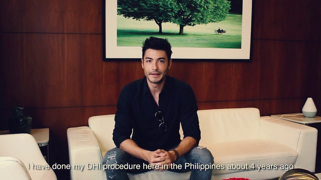 Best Hair Transplant Clinic: DHI Philippines. International model describes his experience.