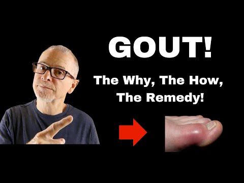 Gout The Why The How The Remedy