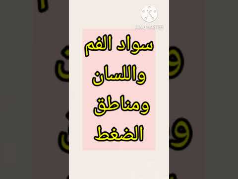 علامات مرض اديسون قصور الغدة الكضرية