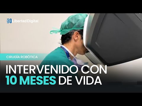 La IMPRESIONANTE cirugía ROBÓTICA a un bebé de 10 meses