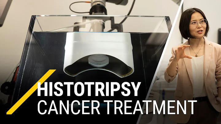 What is Histotripsy? Ultrasound cancer treatment invented at Univ. of Michigan and approved by FDA