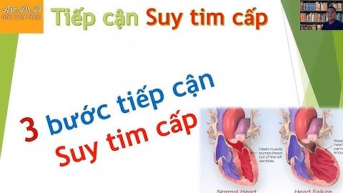 3 bước tiếp cận Suy tim Cấp tại Cấp cứu