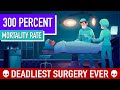 The Story of Robert Liston: A Historical Surgical Perspective