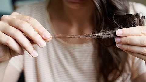 ¿Qué fruta es mejor para frenar la caída del cabello?