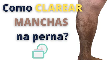 O que usar para tirar manchas de dermatite?