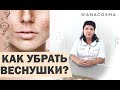 Как убрать веснушки☀️ Удалить веснушки - это навсегда?☀️