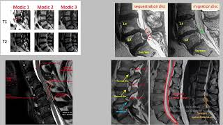 Neuroimaging part 5