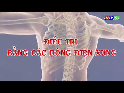 ĐIỆN XUNG