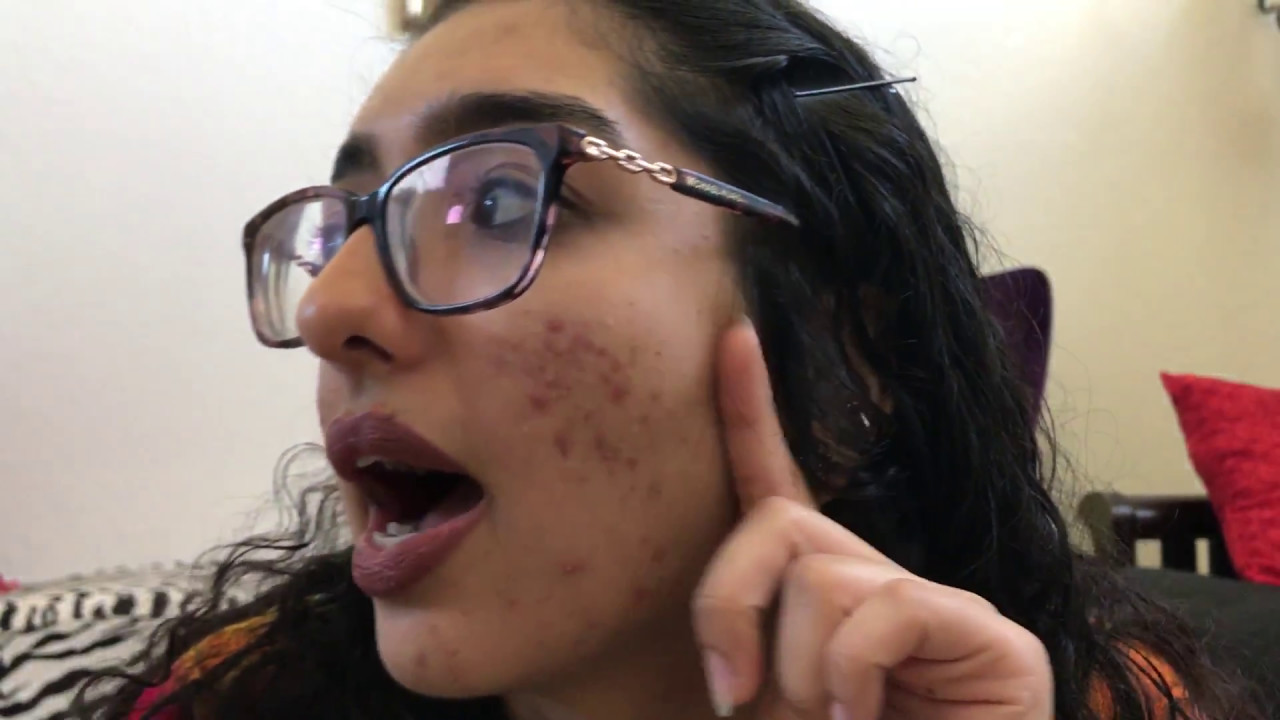 Acne Update 1 Solodyn & Ziana YouTube