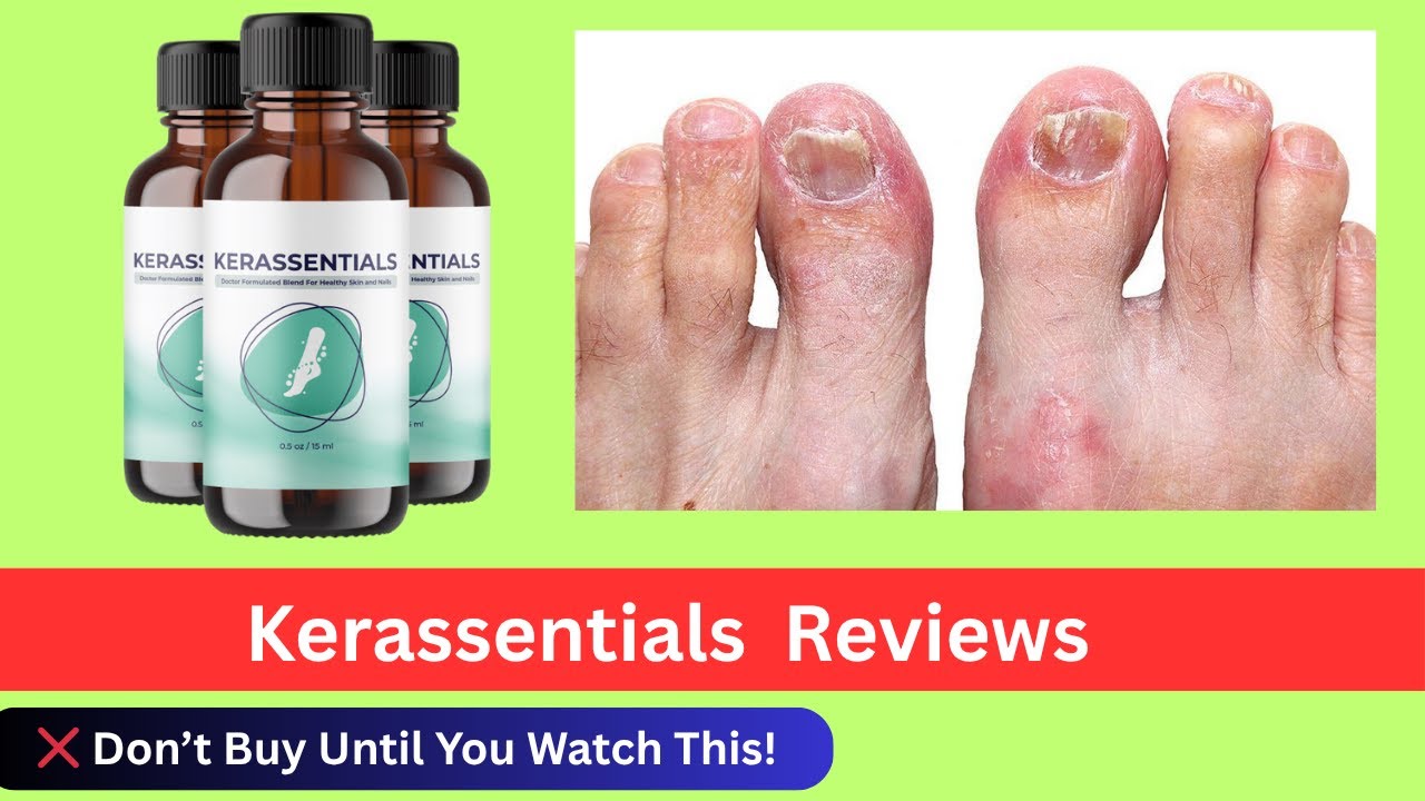 Kerassentials SHOCKING Review 2025 – Truth About This Nail Fungus Oil!