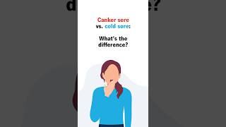 Canker sore vs cold sore: What's the difference?