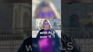 Dallas clinical trial tests experimental treatment for ALS | NBC DFW