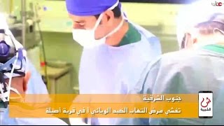 علوم الشبيبة - تفشي مرض التهاب الكبد الوبائي أ في قرية أصيلة
