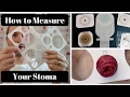 How to Measure Your Stoma: OSTOMY TIPS