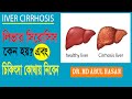 what is liver cirrhosis ? ; কেন হয়, লক্ষণ এবং চিকিৎসা কোথায় নিবেন - জেনে নিন।