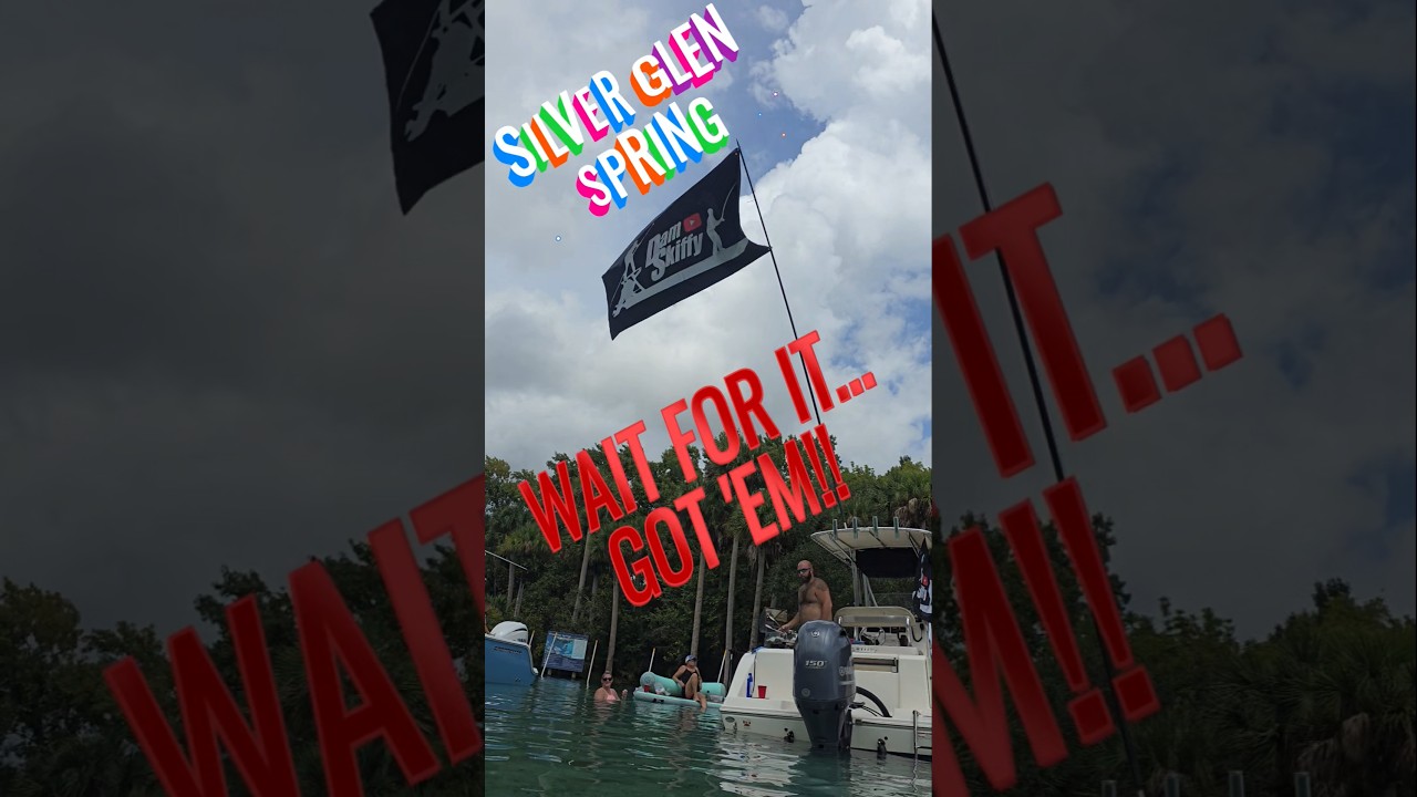 BURNED BY THE GRILL at Silver Glen Spring! 