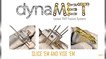 FootInnovate Panel Discussion - dynaMet™ System Introduction