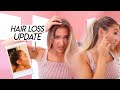 FEW DAYS IN MY LIFE | hair loss update, getting our couch, and date night with my fiance!