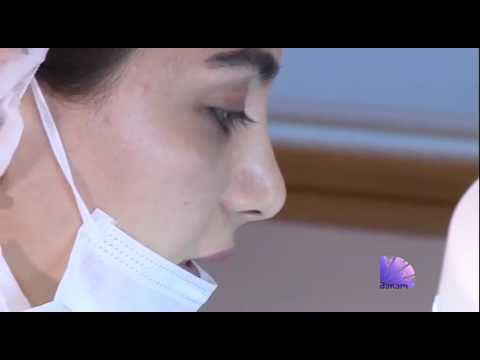კლინიკა მედი - ცხვირ-ტუჩის ნაოჭის შევსება