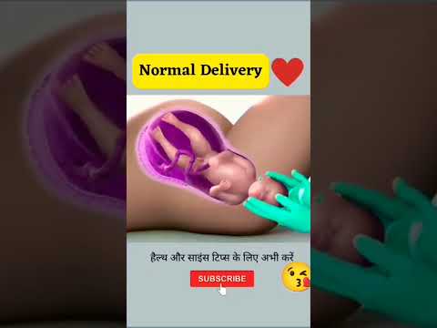 Normal Child Delivery Baby Birth Shorts Youtubeshorts Viral 2024