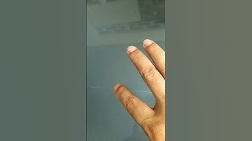 TV LG 32in bị sọc ngang màn hình