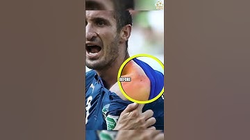 Suárez: The Vampire of Football🧛‍♂️