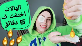 تخلصي سريعا من الهالات السوداء مكون طبيعي يخلصك من التجاعيد حول العين وترهل الجفون في 5 دقائق فقط