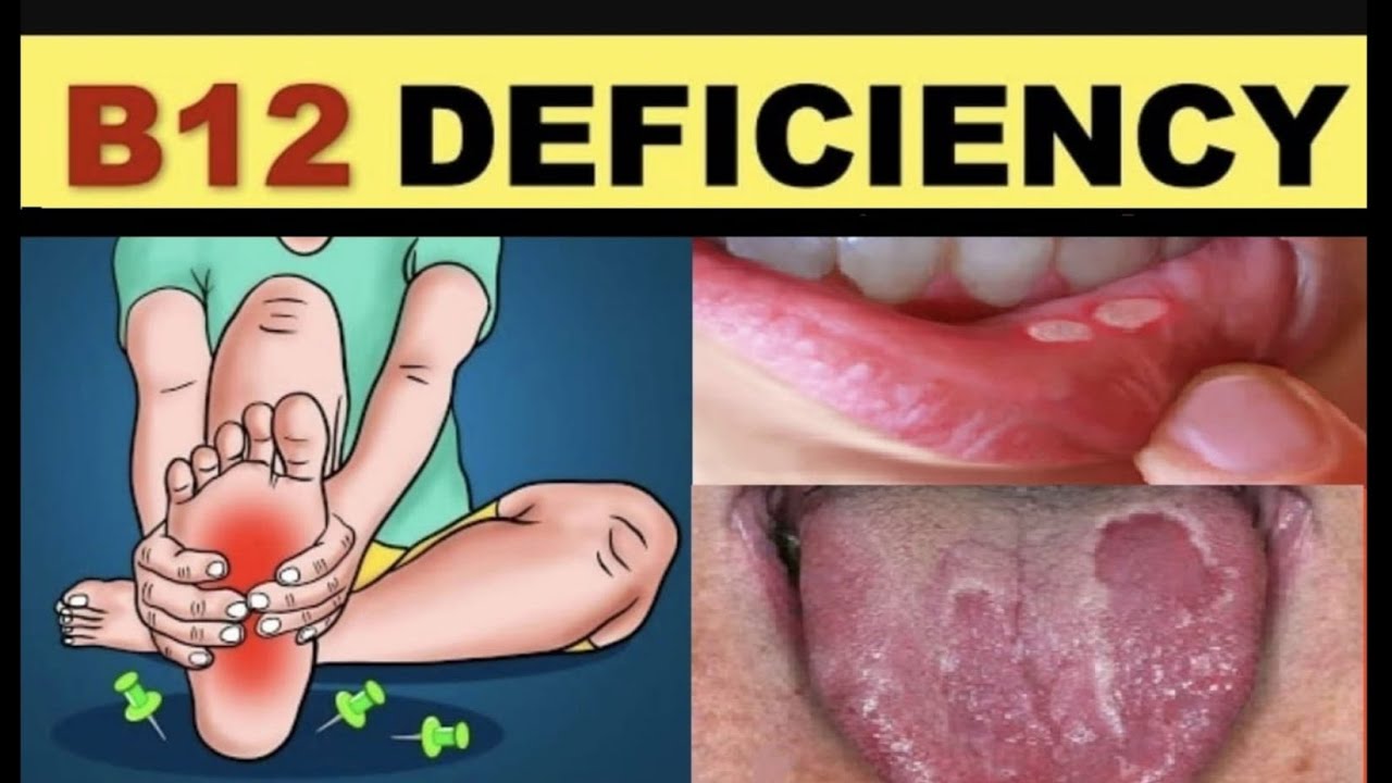 12 how Vitamin B12 Deficiency Effects Our 12-how-vitamin-b12-deficiency-effects-our
