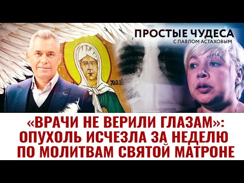 «ВРАЧИ НЕ ВЕРИЛИ ГЛАЗАМ»: ОПУХОЛЬ ИСЧЕЗЛА ЗА НЕДЕЛЮ ПО МОЛИТВАМ СВЯТОЙ МАТРОНЕ. ПРОСТЫЕ ЧУДЕСА