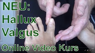 Hallux Valgus online Video Kurs - Vorankündigung