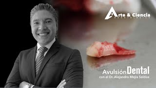 ►Avulsión Dental | Dr. Alejandro Mejia Saldúa