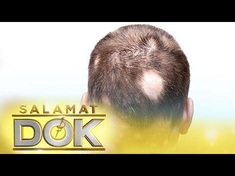 Video: 12 Mga paraan upang gamutin ang Lalaki na pattern sa Pagkawala ng Buhok