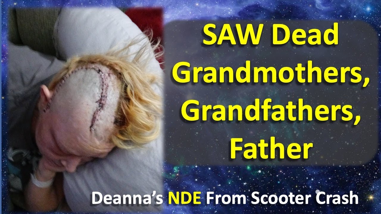 Deanna's NDE (Near Death Experience) After Horrific E-Scooter Accident