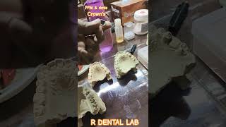 R DENTAL lab. work 🤝