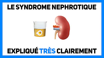 Comment guérir d'un syndrome néphrotique ?