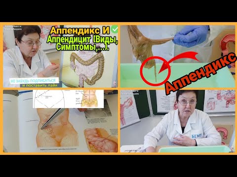 Video: Kataralni Apendicitis