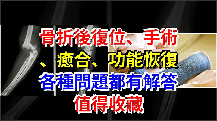 骨折后复位、手术、愈合、功能恢复，各种问题都有解答，值得收藏 - 天天要闻