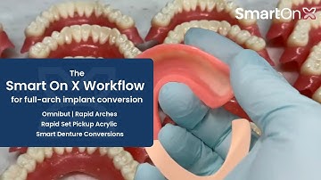 Smart On X Workflow | Omnibut, Rapid Arches, Rapid Set Pickup Acrylic and Smart Denture Conversions